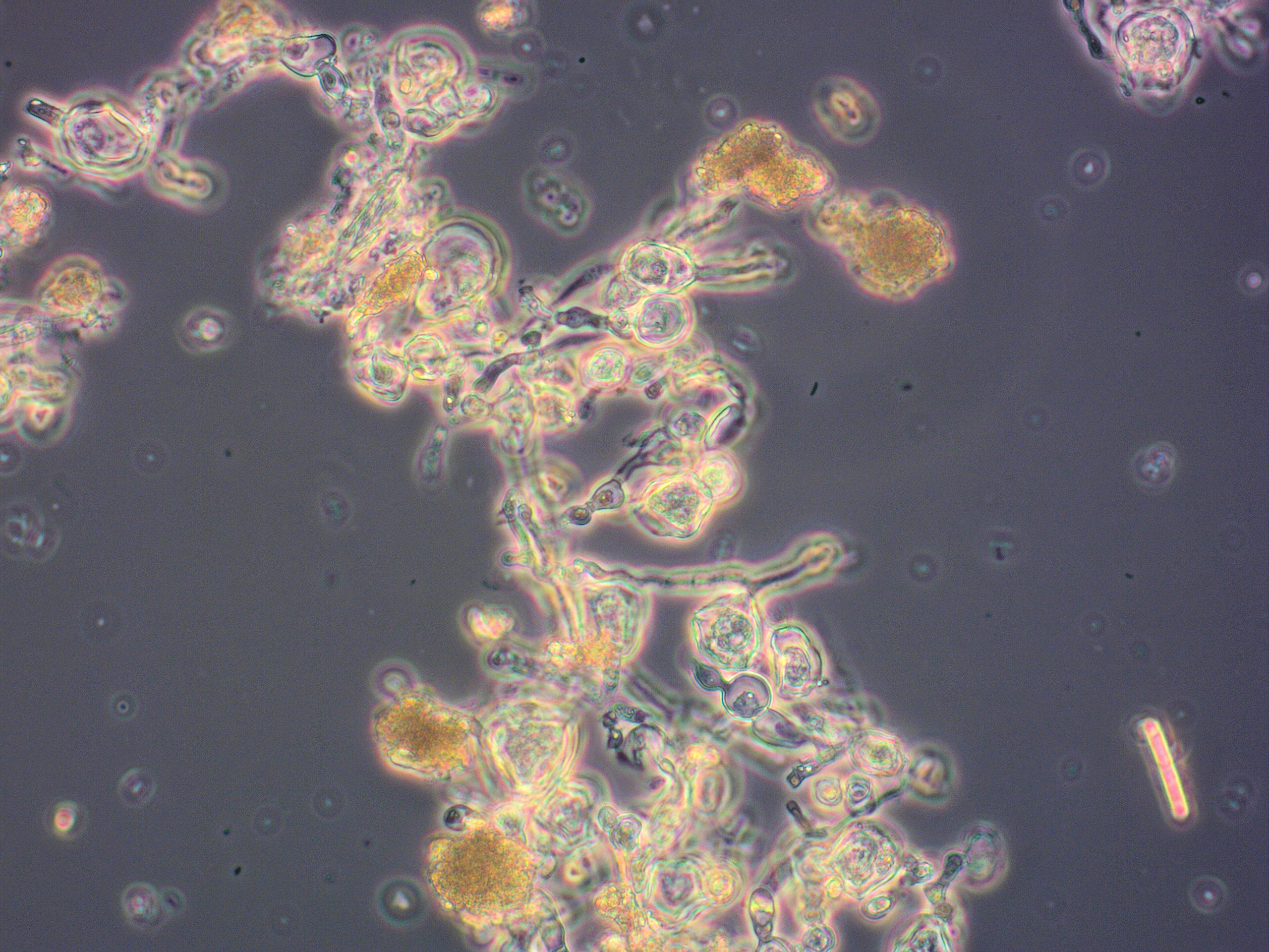 Zu den in der neuen Anlage verwendeten Mikroorganismen zählt auch der Pilz Penicillium coprobium der zur Gewinnung des direkten Vorläufers des Insektizids Inscalis® fermentiert wird. Das Bild zeigt die Pilzzellen in ihrer Fermentationsbrühe.