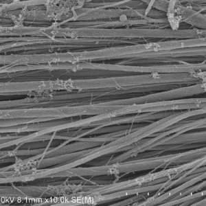 Kollagenfaserbündel nach der Mineralisation mit dem Knochenmineral Kalziumphosphat unter dem Elektronenmikroskop